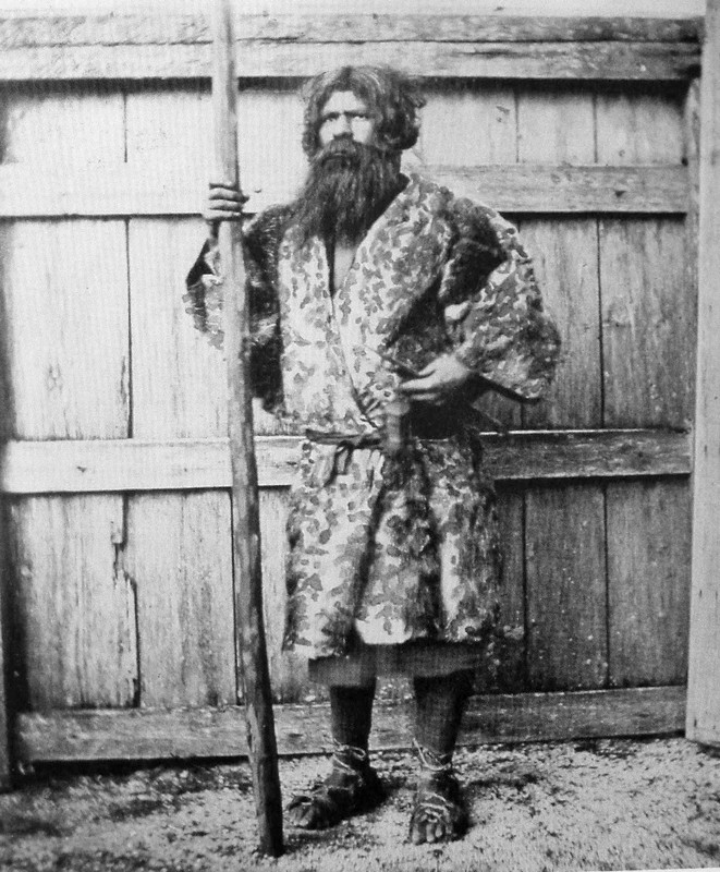Ainuovia boli tiež predmetom podozrenia. Boli zvyčajne menši a zavalitejší ako väčšina Japoncov a mali podstatne viac ochlpenia na tele. Muži Ainu si pestovali dlhé brady, čo je najnejaponská črta.